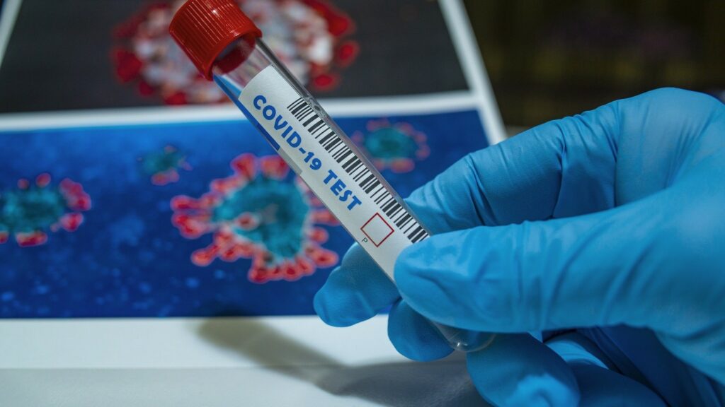 Dépistage du coronavirus. // Source : Pixabay Dépistage du coronavirus. // Source : Pixabay