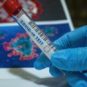 Dépistage du coronavirus. // Source : Pixabay