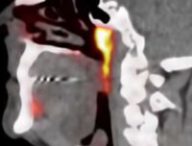 Source : Antoni Van Leeuwenhoek sur Youtube