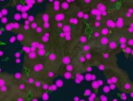 Zoom sur la France... si vous arrivez encore à la voir. // Source : Capture d'écran le 13 novembre 2020