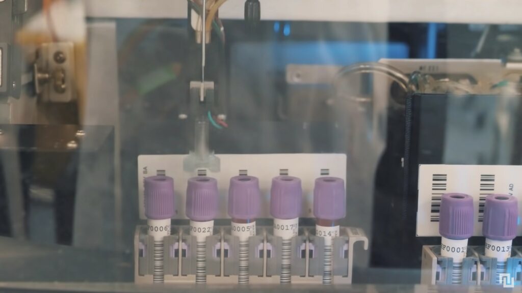 Échantillons de tests PCR. // Source : Numerama Échantillons de tests PCR. // Source : Numerama