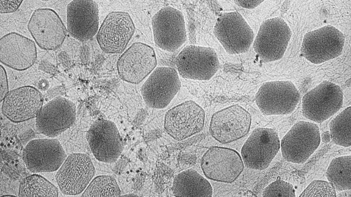 Bactériophages -- virus qui infectent des bactéries. // Source : Zeiss Microscopy / Flickr / CC Bactériophages -- virus qui infectent des bactéries. // Source : Zeiss Microscopy / Flickr / CC