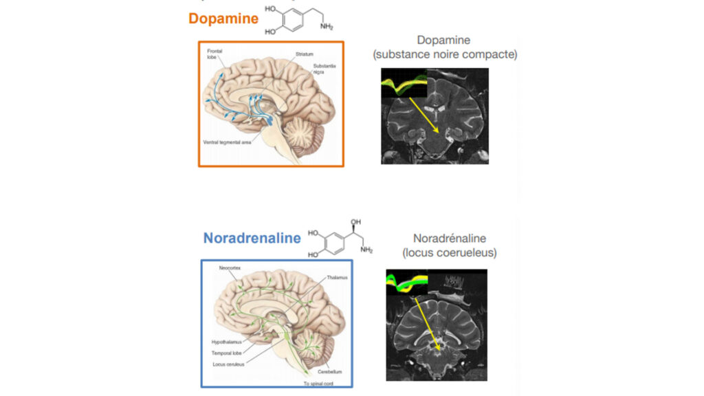 Dopamine et Noradrénaline. // Source : Sébastien Bouret Dopamine et Noradrénaline. // Source : Sébastien Bouret