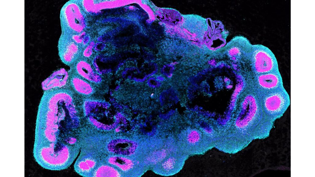 Organoïde humain, modèle des tissus cérébraux. // Source : S.Benito-Kwiecinski/MRC LMB/Cell Organoïde humain, modèle des tissus cérébraux. // Source : S.Benito-Kwiecinski/MRC LMB/Cell