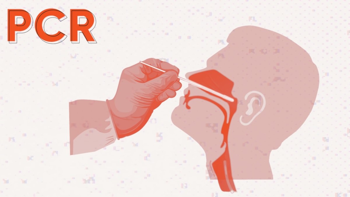 Test RT-PCR par prélèvement nasopharyngé. // Source : Illustration Numerama/Louise Audry Test RT-PCR par prélèvement nasopharyngé. // Source : Illustration Numerama/Louise Audry