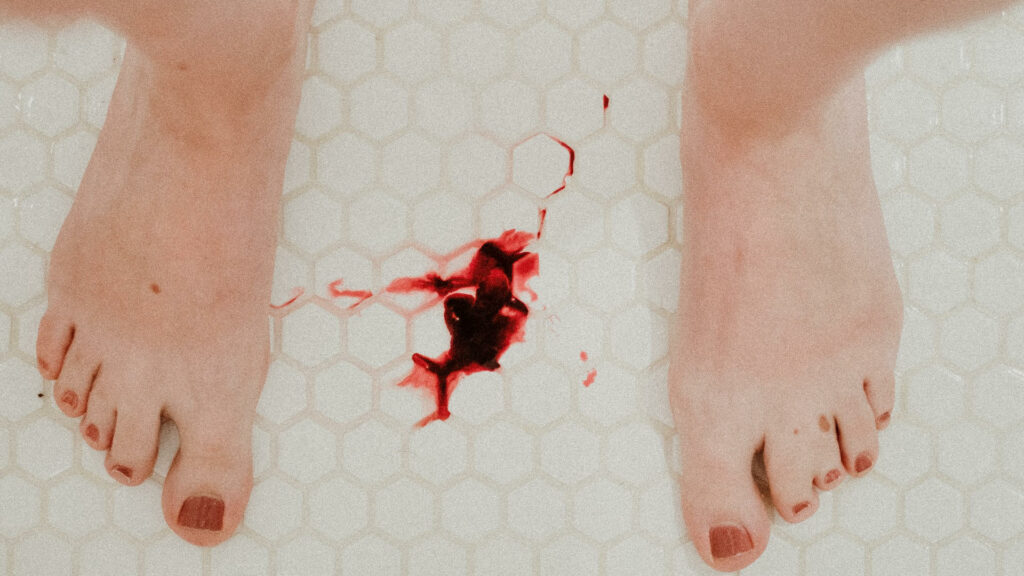 Retard de règle, flux augmenté... les perturbations du cycle menstruel après la vaccination Covid sont surveillées. // Source : Monika Kozub / Unsplash Retard de règle, flux augmenté... les perturbations du cycle menstruel après la vaccination Covid sont surveillées. // Source : Monika Kozub / Unsplash