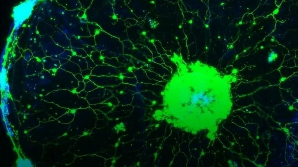 Le réseau de neurones de ces méduses, au microscope, après modification génétique permettant de rendre fluo les neurones activés. // Source : Cell, 2021 Le réseau de neurones de ces méduses, au microscope, après modification génétique permettant de rendre fluo les neurones activés. // Source : Cell, 2021