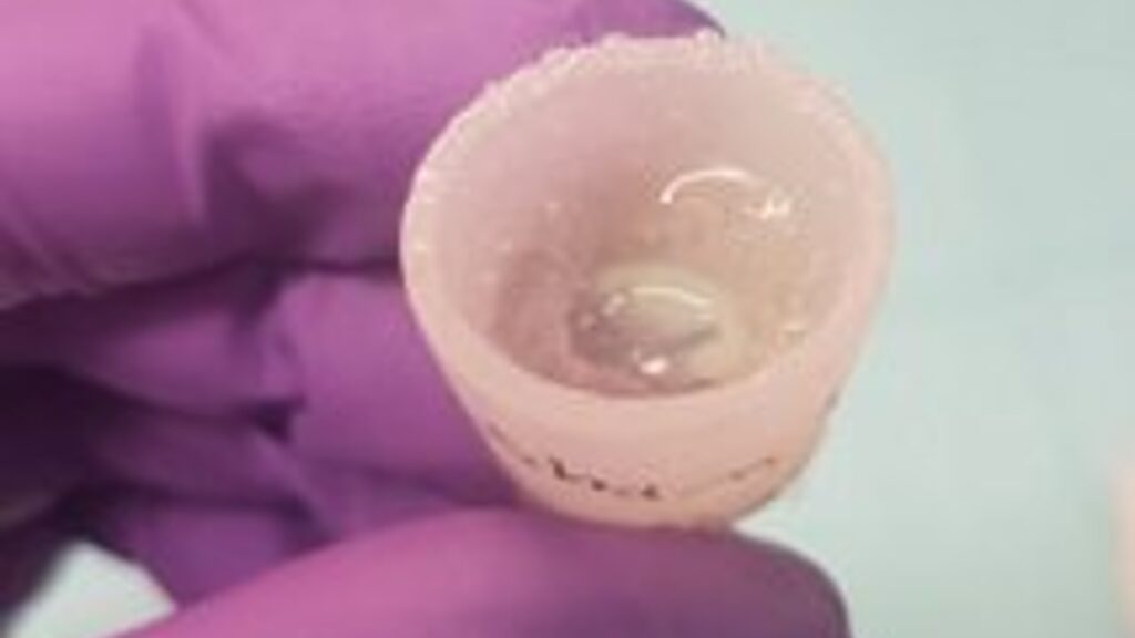 Voici à quoi ressemble le BioDome, une sorte de bouchon, en silicone. // Source : Nirosha Murugan / Université Tufts Voici à quoi ressemble le BioDome, une sorte de bouchon, en silicone. // Source : Nirosha Murugan / Université Tufts