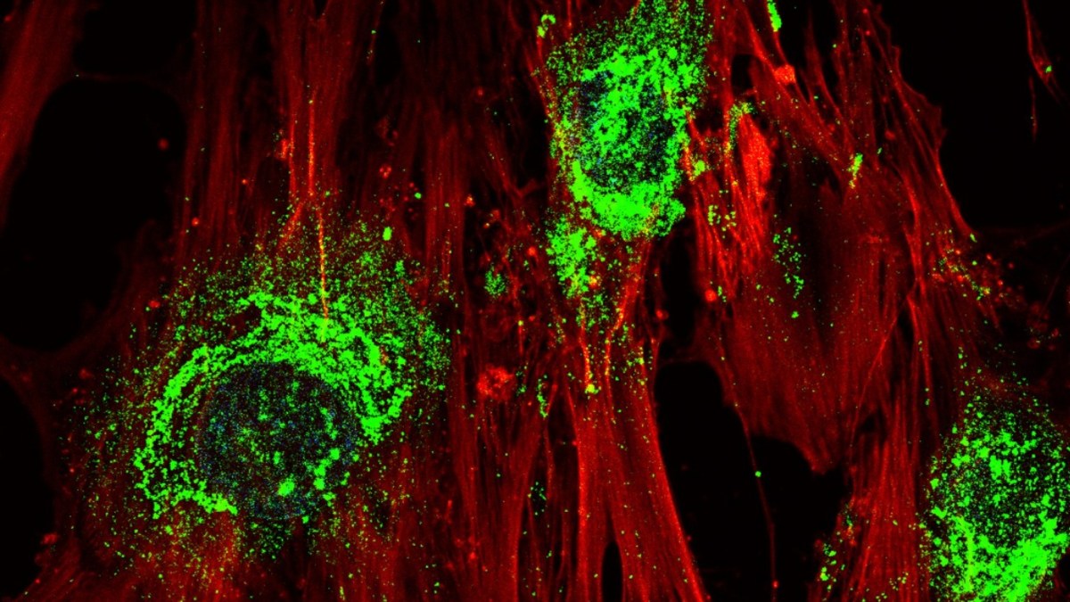 Source : RMIT University Source : RMIT University