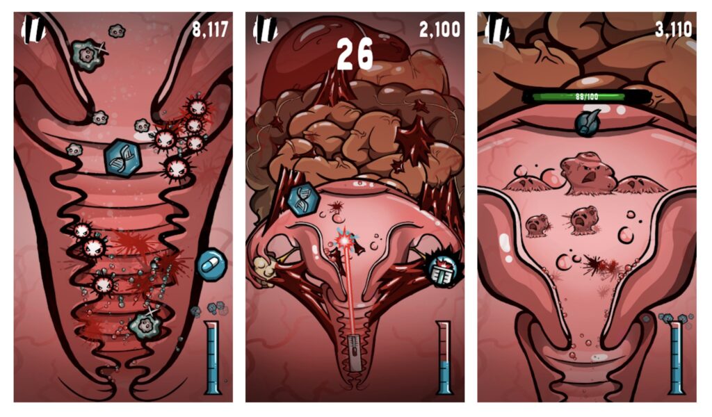 Etes-vous prêts à vous battre contre des fibromes ? // Source : Utter US Etes-vous prêts à vous battre contre des fibromes ? // Source : Utter US