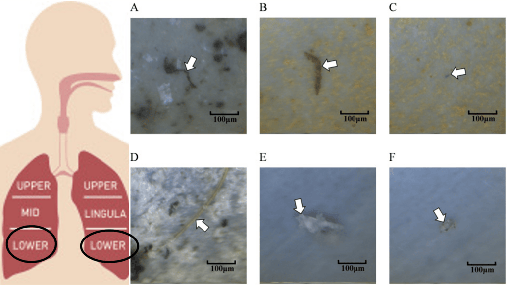 Les particules microplastiques se frayent un chemin jusqu'à la région inférieure des poumons (« lower »). // Source : Jenner et al., Science of the Total Environment, 2022 Les particules microplastiques se frayent un chemin jusqu'à la région inférieure des poumons (« lower »). // Source : Jenner et al., Science of the Total Environment, 2022