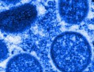 Micrographie électronique de particules de virus de la variole du singe isolés en 2003 aux États-Unis, dans des échantillons humains // Source : The Conversation / Cynthia S. Goldsmith, Russell Regner / CDC / AP Micrographie électronique de particules de virus de la variole du singe isolés en 2003 aux États-Unis, dans des échantillons humains // Source : The Conversation / Cynthia S. Goldsmith, Russell Regner / CDC / AP