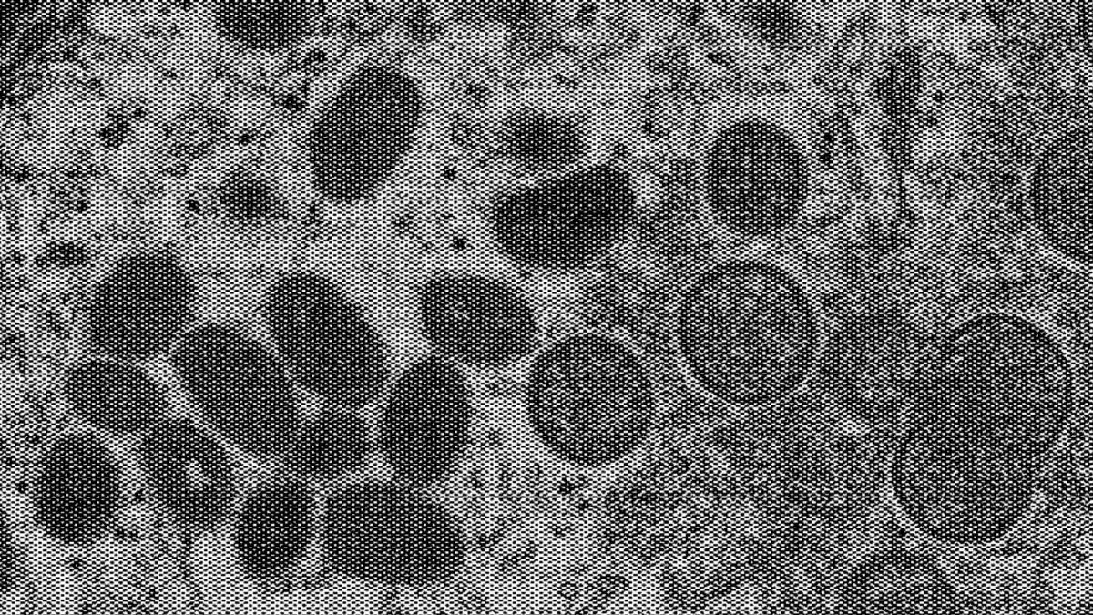 Variole du singe (image modifiée) // Source : CDC Variole du singe (image modifiée) // Source : CDC