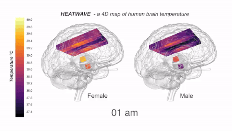 Carte baptisée Heatwave de la chaleur du cerveau. // Source : N RZECHORZEK/MRC LMB/BRAIN Carte baptisée Heatwave de la chaleur du cerveau. // Source : N RZECHORZEK/MRC LMB/BRAIN