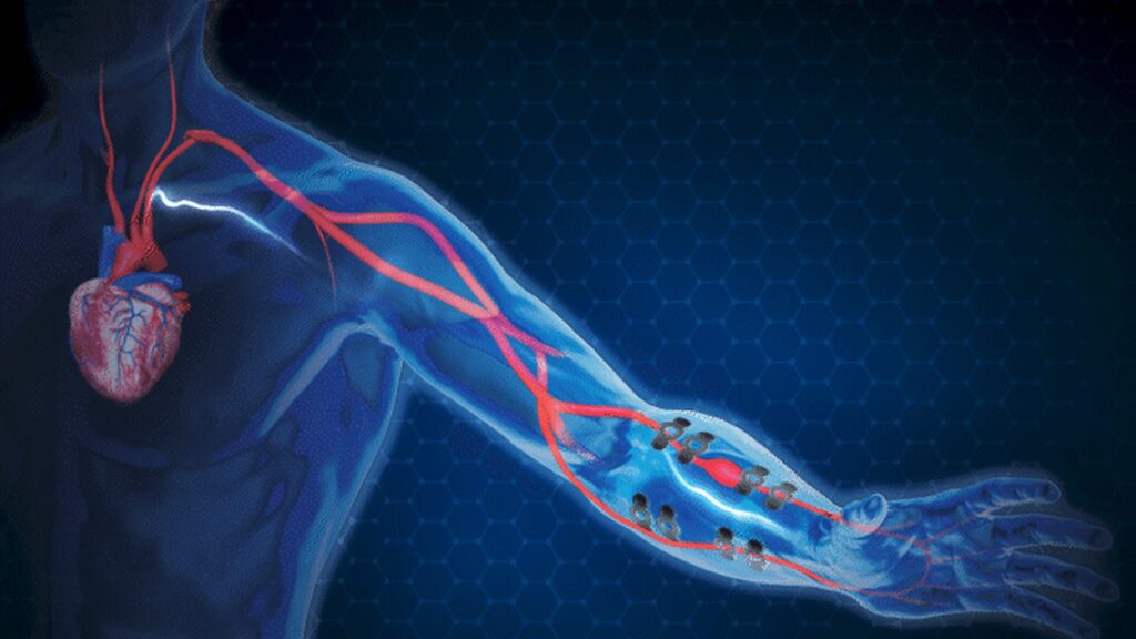 Les tatouages, très peu visibles, mesurent la bioimpédance et ainsi livrent des informations sur la pression artérielle. // Source : University of Texas at Austin Les tatouages, très peu visibles, mesurent la bioimpédance et ainsi livrent des informations sur la pression artérielle. // Source : University of Texas at Austin