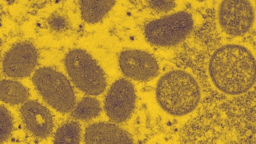 Variole du singe au microscope // Source : CDC Variole du singe au microscope // Source : CDC