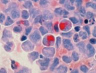Source : National Cancer Institute Source : National Cancer Institute