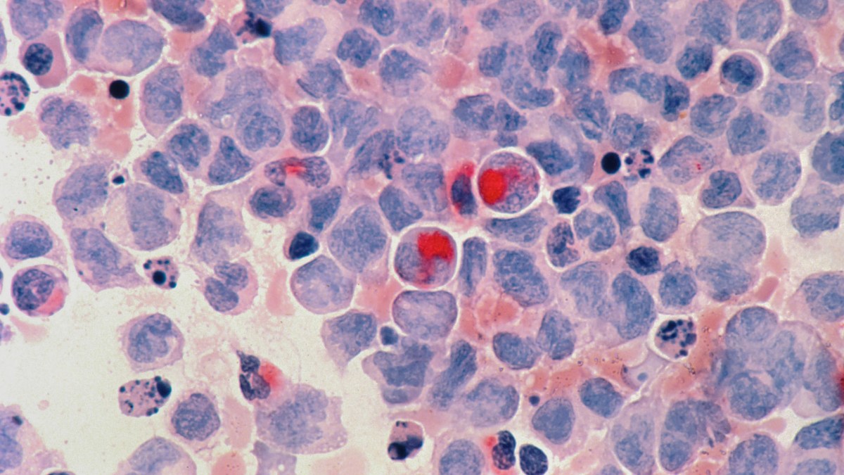 Source : National Cancer Institute Source : National Cancer Institute