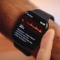 Apple Watch Series 8 // Source : Louise Audry / Numerama Apple Watch Series 8 // Source : Louise Audry / Numerama
