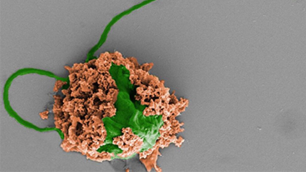 Ces microrobots sont conçus à partir de cellules d'algues et de membrane de globule blanc. // Source : UCSD/Université San Diego Ces microrobots sont conçus à partir de cellules d'algues et de membrane de globule blanc. // Source : UCSD/Université San Diego