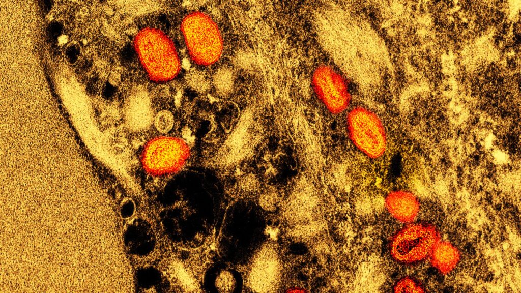 Le virus de la variole du singe // Source : Wikimedia Commons Le virus de la variole du singe // Source : Wikimedia Commons