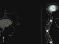 Elon Musk’s Neuralink Event_ Everything Revealed in 10 Minutes 2-10 screenshot