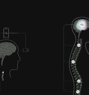 Elon Musk’s Neuralink Event_ Everything Revealed in 10 Minutes 2-10 screenshot