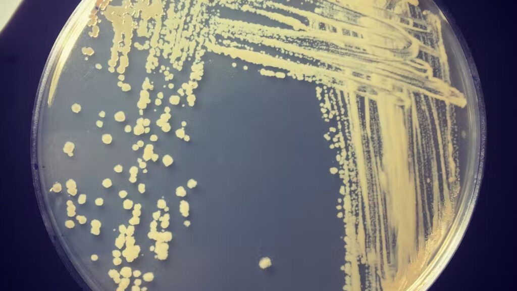 L'enzyme Huc isolée en laboratoire. // Source : Rhys Grinter/The Conversation L'enzyme Huc isolée en laboratoire. // Source : Rhys Grinter/The Conversation