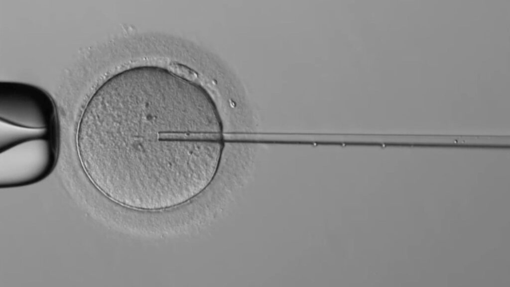 L'aiguille manipulée par le robot, dans l'ovule. // Source : Capture d'écran Overture L'aiguille manipulée par le robot, dans l'ovule. // Source : Capture d'écran Overture