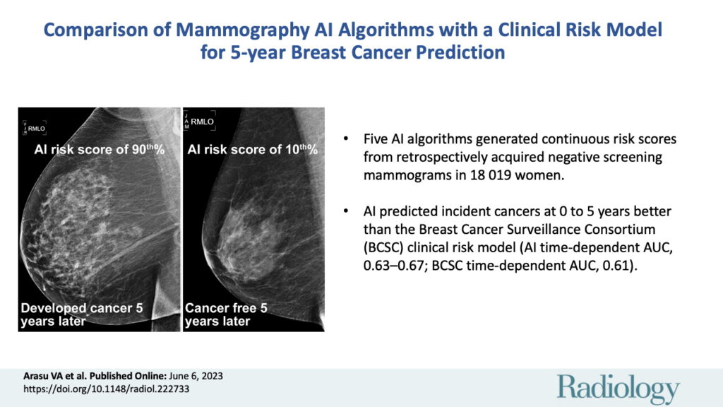 L'IA analyse les mammographies pour prédire s'il existe un risque de cancer du sein. // Source : Radiology L'IA analyse les mammographies pour prédire s'il existe un risque de cancer du sein. // Source : Radiology