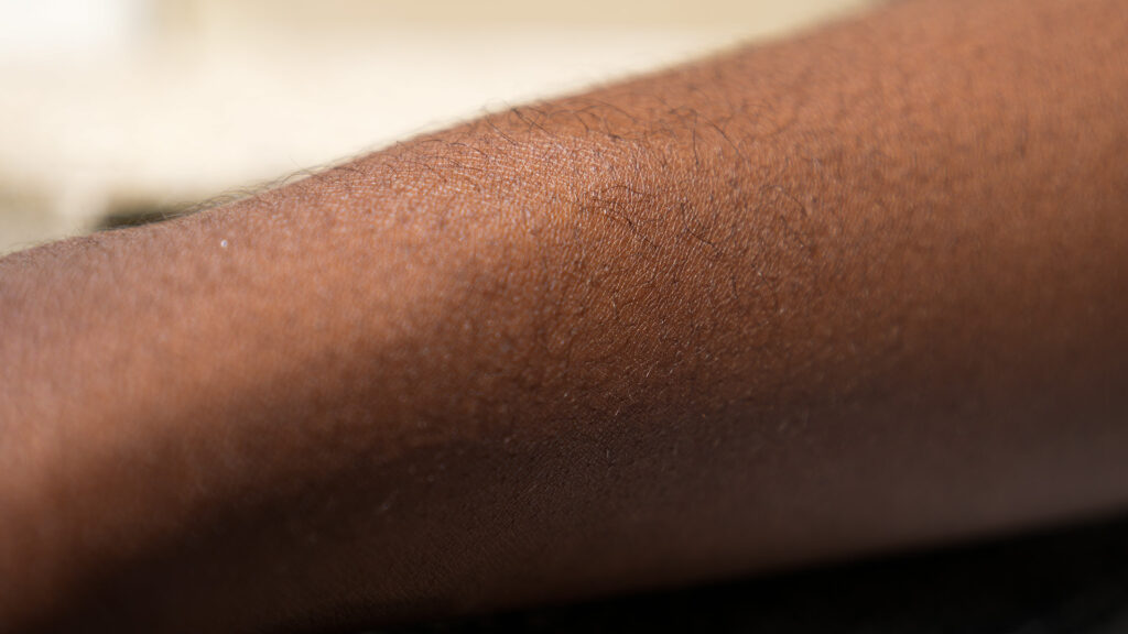 Une peau « noire » se déshydrate plus vite qu'une peau blanche. Il faut donc se protéger du Soleil // Source : Nino Barbey pour Numerama Une peau « noire » se déshydrate plus vite qu'une peau blanche. Il faut donc se protéger du Soleil // Source : Nino Barbey pour Numerama