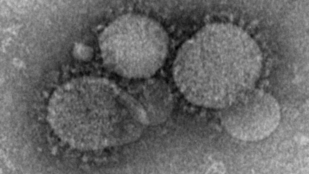 MERS-CoV // Source : CDC/Maureen Metcalfe/Cynthia Goldsmith/Azaibi Tamin MERS-CoV // Source : CDC/Maureen Metcalfe/Cynthia Goldsmith/Azaibi Tamin
