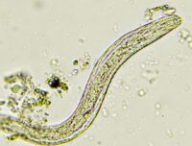 Pinworm // Source : Canva