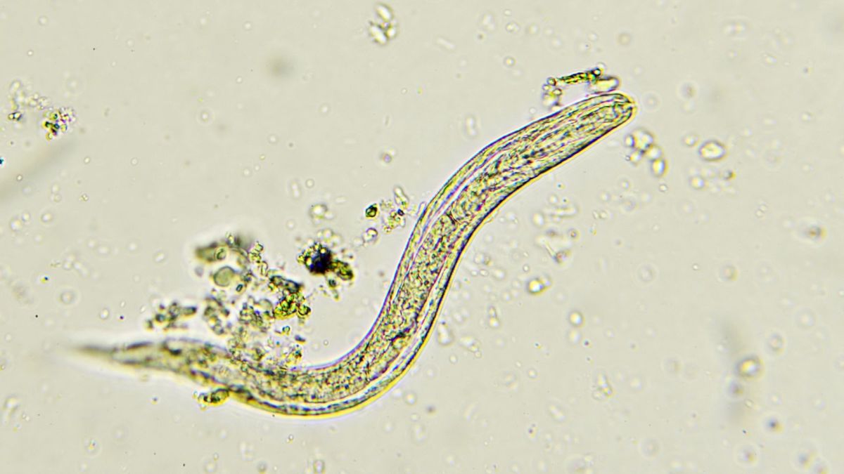 Pinworm // Source : Canva Pinworm // Source : Canva