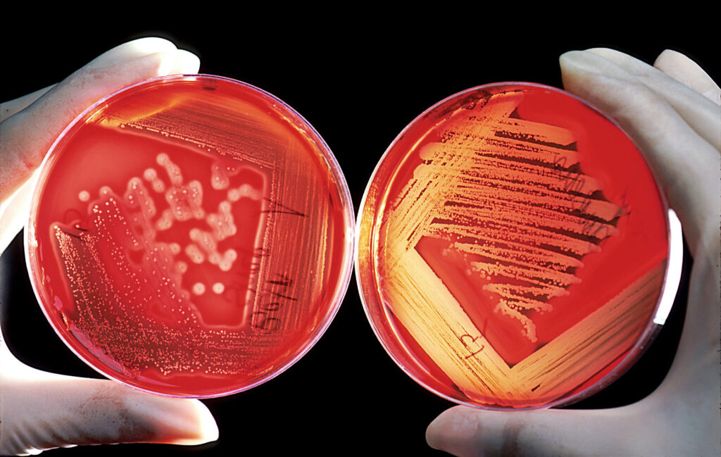 Recto verso d'une boîte avec culture de bactéries sur un gel d'agar. // Source : Bill Branson