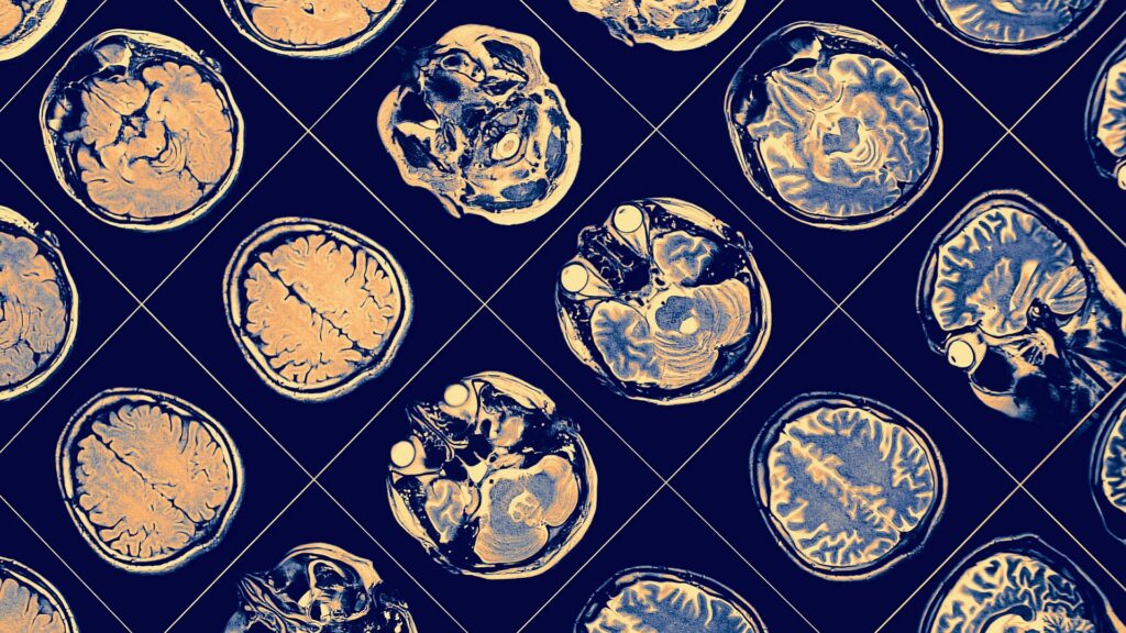 cerveau cerveau
