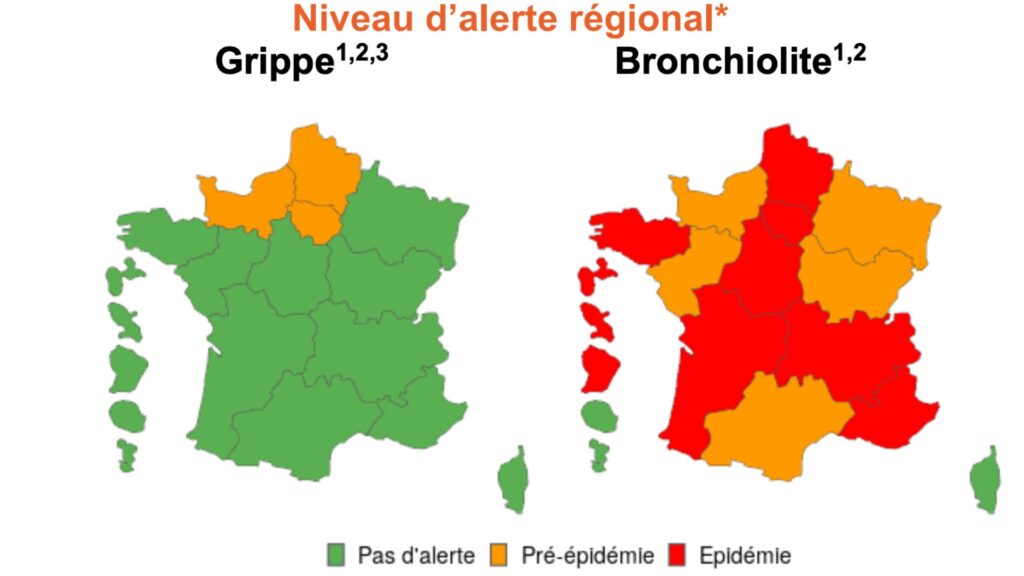 Au 27 novembre 2024. // Source : Santé publique France Au 27 novembre 2024. // Source : Santé publique France