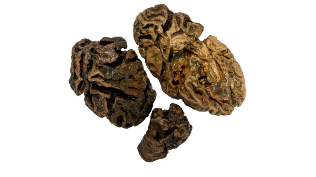 Fragments de cerveau d'un individu enterré dans un cimetière de travail victorien (Bristol, Royaume-Uni), il y a environ 200 ans // Source : Alexandra L. Morton-Hayward. Fragments de cerveau d'un individu enterré dans un cimetière de travail victorien (Bristol, Royaume-Uni), il y a environ 200 ans // Source : Alexandra L. Morton-Hayward.