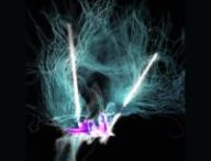 Une représentation visuelle de la stimulation cérébrale profonde de l'hypothalamus latéral dans l'étude par . NeuroRestore à l'EPFL // Source : NeuroRestore / EPFL 2024 Une représentation visuelle de la stimulation cérébrale profonde de l'hypothalamus latéral dans l'étude par . NeuroRestore à l'EPFL // Source : NeuroRestore / EPFL 2024