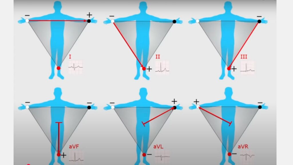 ***** // Source : Capture d'écran vidéo YT "ECG Watch: How it Works (Apple, Samsung A fib Watches / EKG)" ***** // Source : Capture d'écran vidéo YT "ECG Watch: How it Works (Apple, Samsung A fib Watches / EKG)"