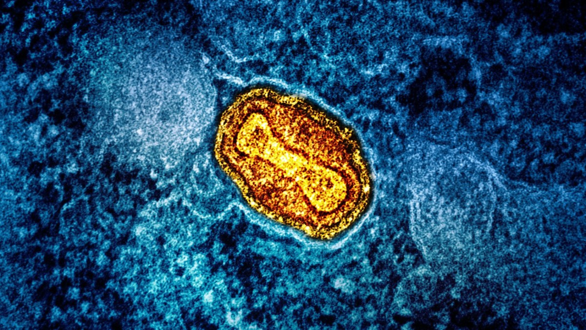 Source : NIAID (particule de mpox au microscope) Source : NIAID (particule de mpox au microscope)