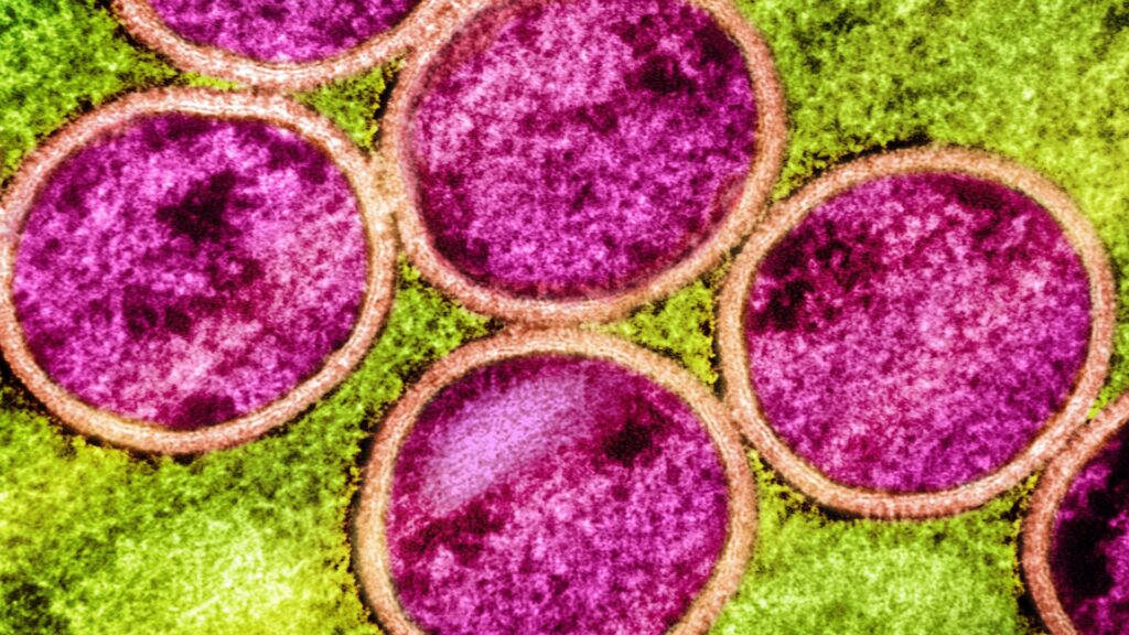 Micrographie électronique à transmission colorisée de particules immatures du virus mpox (rose avec enveloppe virale orange) trouvées dans une cellule VERO E6 infectée (verte), cultivée en laboratoire. // Source : Image prise au NIAID Integrated Research Facility (IRF) à Fort Detrick, Maryland. Micrographie électronique à transmission colorisée de particules immatures du virus mpox (rose avec enveloppe virale orange) trouvées dans une cellule VERO E6 infectée (verte), cultivée en laboratoire. // Source : Image prise au NIAID Integrated Research Facility (IRF) à Fort Detrick, Maryland.