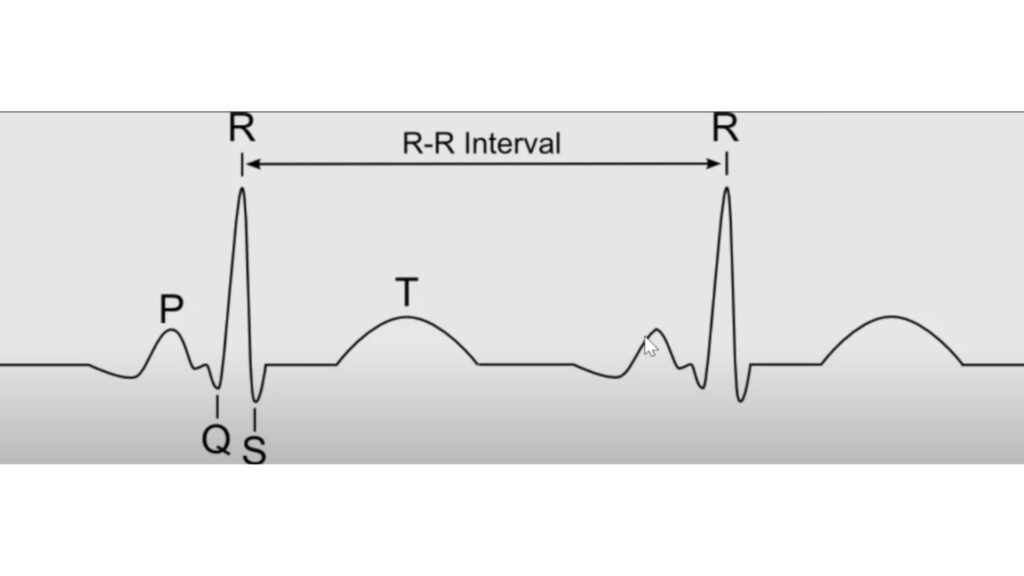 Tracé d'ECG légendé // Source : Capture d'écran vidéo YT "ECG Watch: How it Works (Apple, Samsung A fib Watches / EKG)" Tracé d'ECG légendé // Source : Capture d'écran vidéo YT "ECG Watch: How it Works (Apple, Samsung A fib Watches / EKG)"
