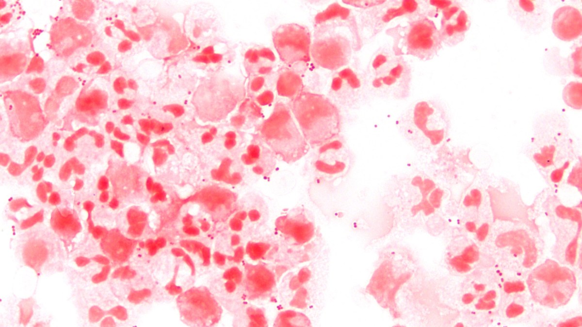Le méningoccoque, aussi appelé Neisseria meningitidis, en latin // Source : Microman12345; Wikipédia Le méningoccoque, aussi appelé Neisseria meningitidis, en latin // Source : Microman12345; Wikipédia
