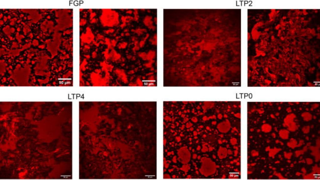 Images de microscopie optique. Les particules de graisse sont indiquées en rouge, le fond sombre est la phase aqueuse et les « aiguilles » pointues rouge vif sont des cristaux de graisse. // Source : Fig 8. Mathias Baechle, Arlete M. L. Marques, Matias A. Via, Mathias P. Clausen, Thomas A. Vilgis; Foie gras pâté without force-feeding. Physics of Fluids 1 March 2025; 37 (3): 037196. Images de microscopie optique. Les particules de graisse sont indiquées en rouge, le fond sombre est la phase aqueuse et les « aiguilles » pointues rouge vif sont des cristaux de graisse. // Source : Fig 8. Mathias Baechle, Arlete M. L. Marques, Matias A. Via, Mathias P. Clausen, Thomas A. Vilgis; Foie gras pâté without force-feeding. Physics of Fluids 1 March 2025; 37 (3): 037196.