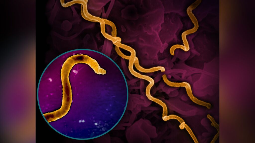 Images de micrographie électronique de Treponema pallidum, la bactérie qui cause la syphilis, y compris un gros plan d'une seule particule. Les bactéries en forme de spirale sont colorées en or // Source : NIAID Images de micrographie électronique de Treponema pallidum, la bactérie qui cause la syphilis, y compris un gros plan d'une seule particule. Les bactéries en forme de spirale sont colorées en or // Source : NIAID