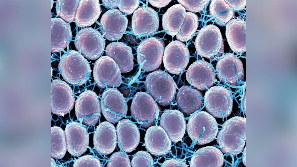 Micrographie électronique à balayage de la bactérie Neisseria gonorrhoeae, qui cause la gonorrhée. // Source : NIAID Micrographie électronique à balayage de la bactérie Neisseria gonorrhoeae, qui cause la gonorrhée. // Source : NIAID