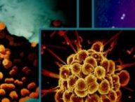 Images de micrographie électronique de bactéries qui causent trois infections sexuellement transmissibles : la chlamydia (à gauche), la gonorrhée (au centre) et la syphilis (à droite). Les bactéries sont colorées orange/or. // Source : NIAID