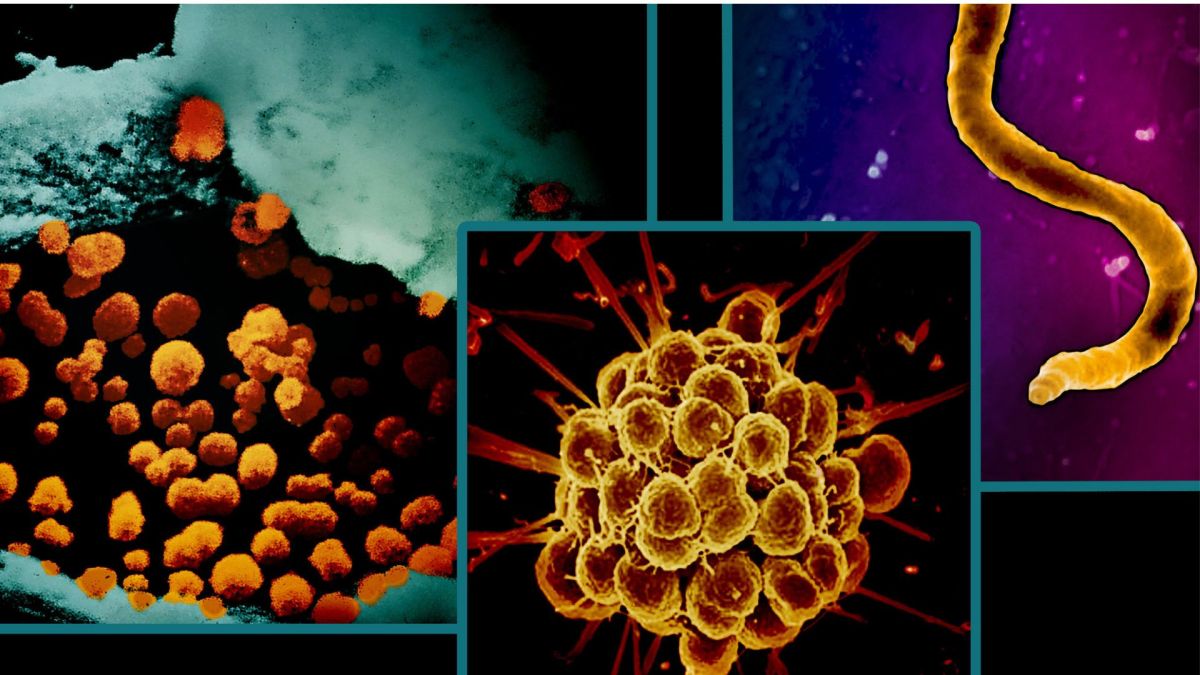 Images de micrographie électronique de bactéries qui causent trois infections sexuellement transmissibles : la chlamydia (à gauche), la gonorrhée (au centre) et la syphilis (à droite). Les bactéries sont colorées orange/or. // Source : NIAID Images de micrographie électronique de bactéries qui causent trois infections sexuellement transmissibles : la chlamydia (à gauche), la gonorrhée (au centre) et la syphilis (à droite). Les bactéries sont colorées orange/or. // Source : NIAID