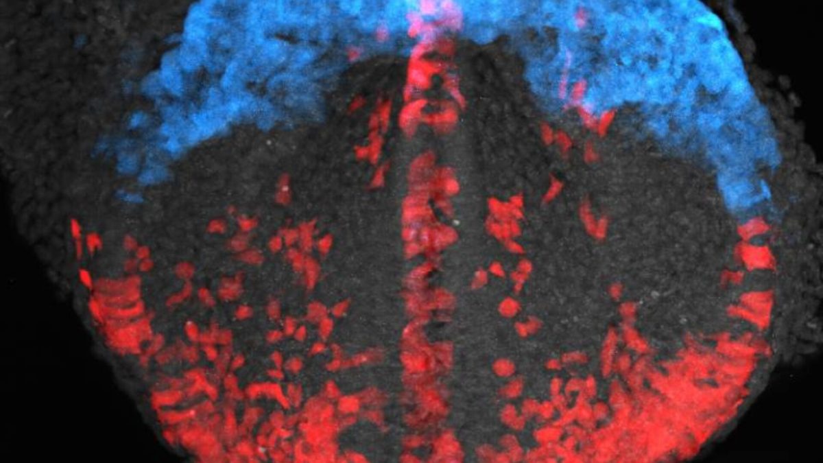 Cerveau de souris avec des cellules marquées par fluorescence // Source : Dr. Ivanovitch et al.